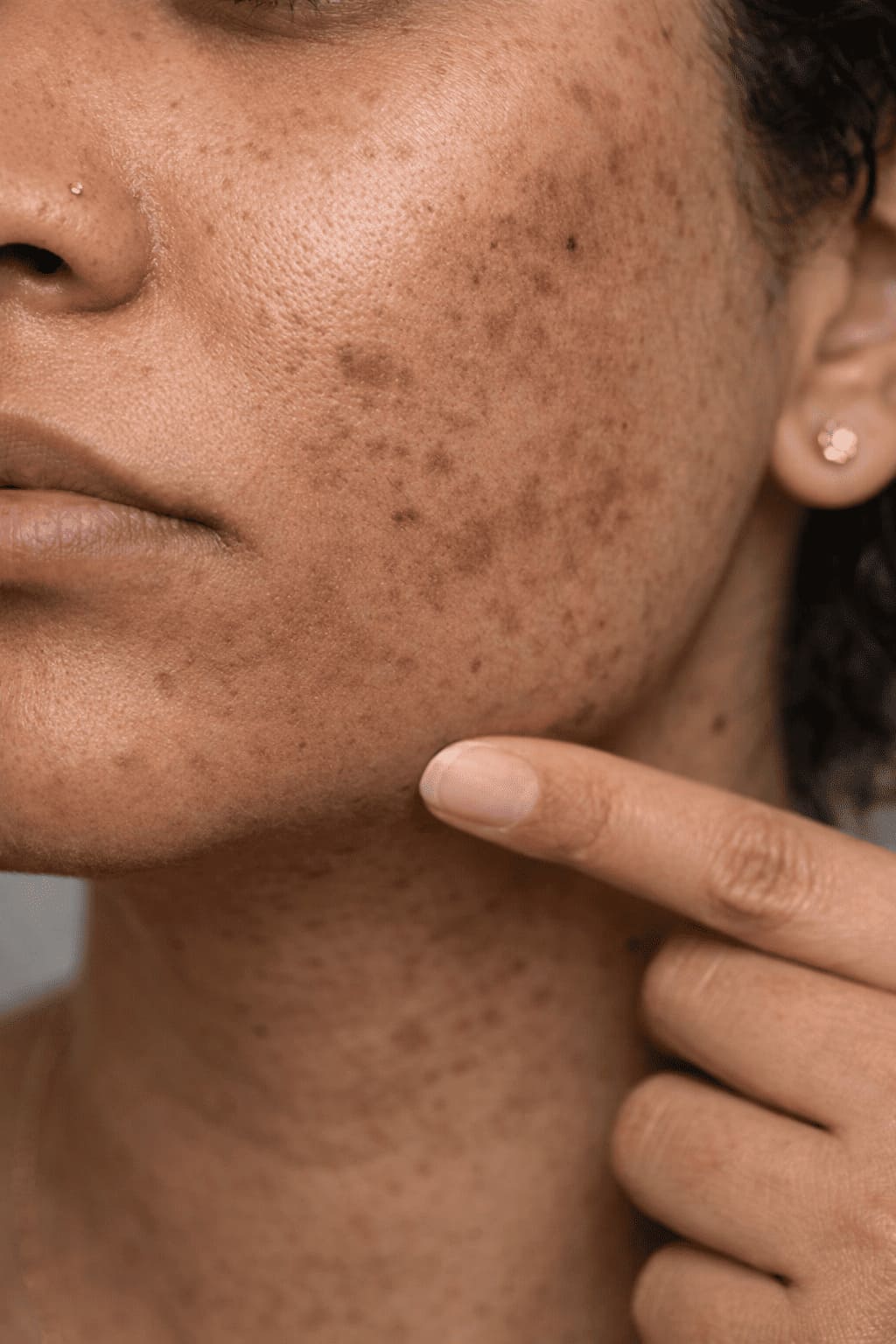 skin therapy